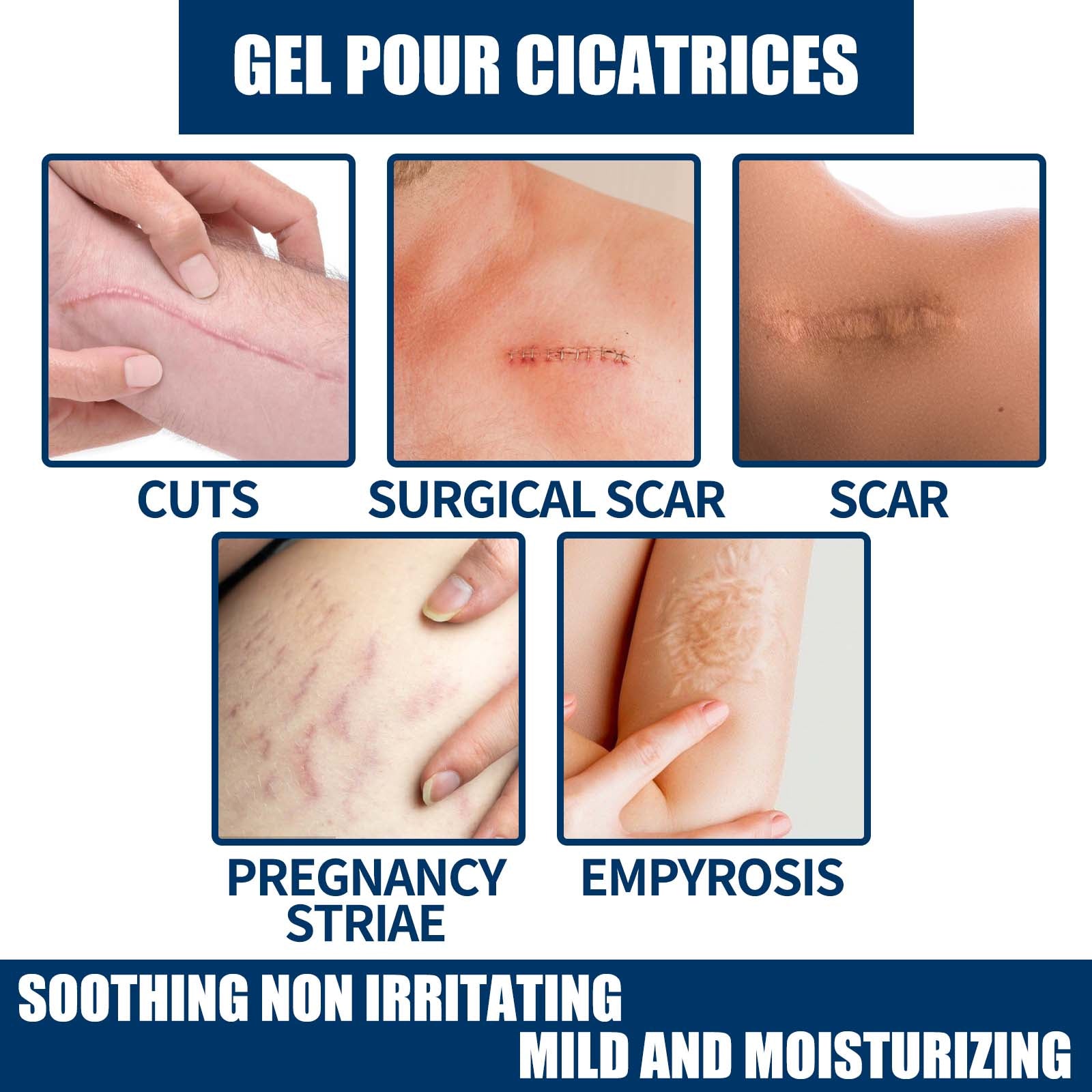 EELHOE Skin Repair Gel Moisturizes Smooth And Moisturizing Skin With Daily Skin Care Gel
