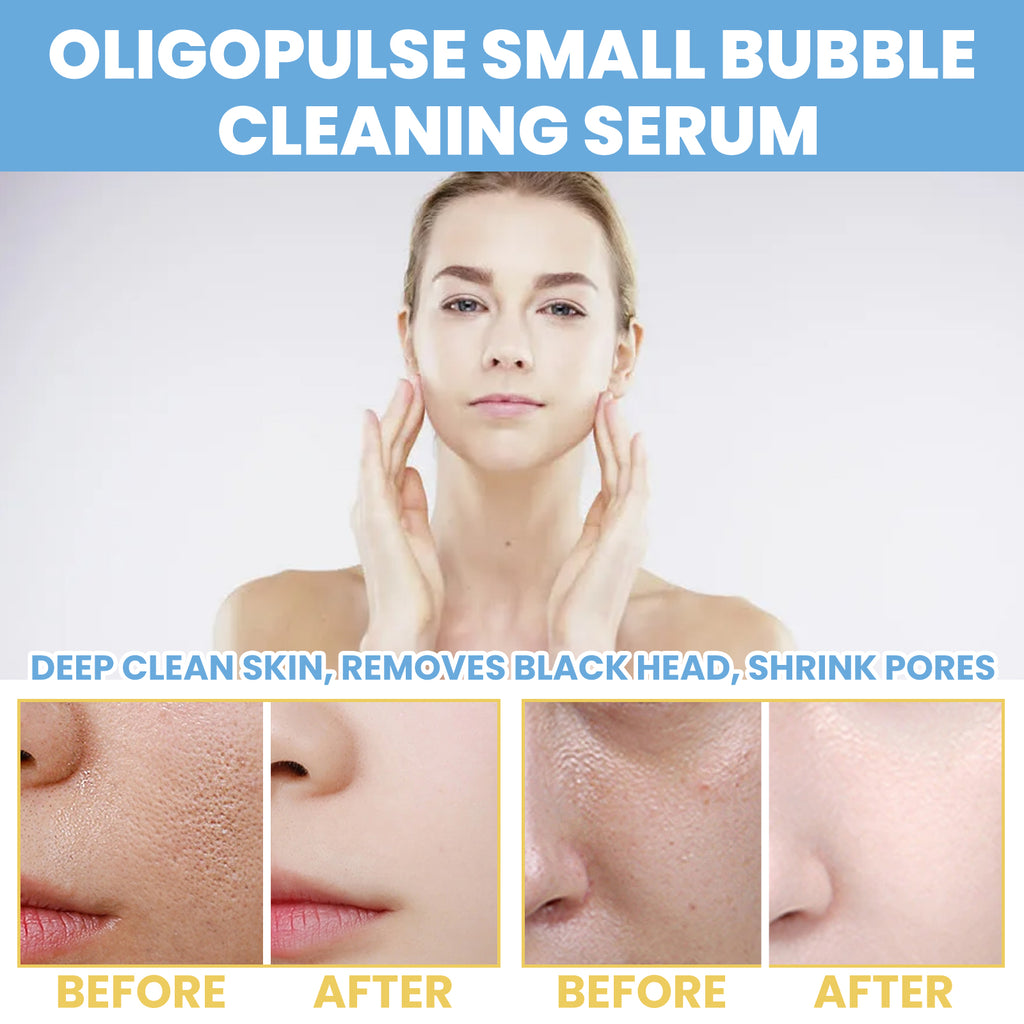 EELHOE Oligopeptide Mini Bubble Cleansing Essence, Pore-Tightening Skin Gentle Deep Clean Blackhead Acne