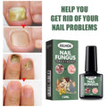 EELHOE Hand, Foot And Nail Polish Repair Solution Hand, Foot And Nail Polish Care Repair Nail Thickening And Softening Solution