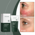 Ouhoe Moisturizing And Protective Cream, A Double Action Moisturizing And Protective Cream That Protects Light Texture And Enhances Skin Hydration All Day Long